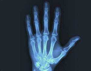 Fluoroscopy Suite