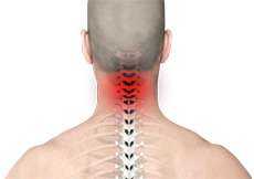 Neck Pain