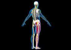 Sciatica