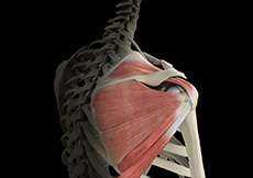 Rotator Cuff Tears